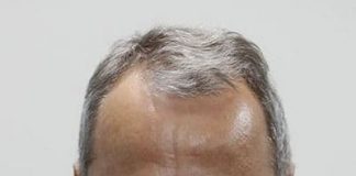 Алексей Ковальков