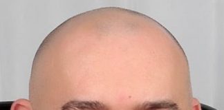 Денис Проценко