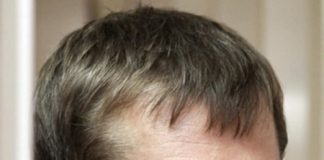 Дмитрий Захарченко