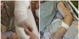 Гадюка укусила ребенка из Бердска. Дошкольник находится в реанимации