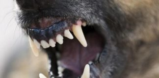 В Улан-Удэ хозяйские собаки покусали шестилетнего ребенка и 30-летнюю женщину