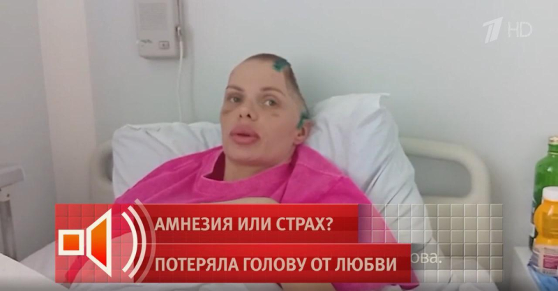 Изувечил ее так, что половины черепа нет: фото модели Анжелики Тартановой, которая вышла из комы