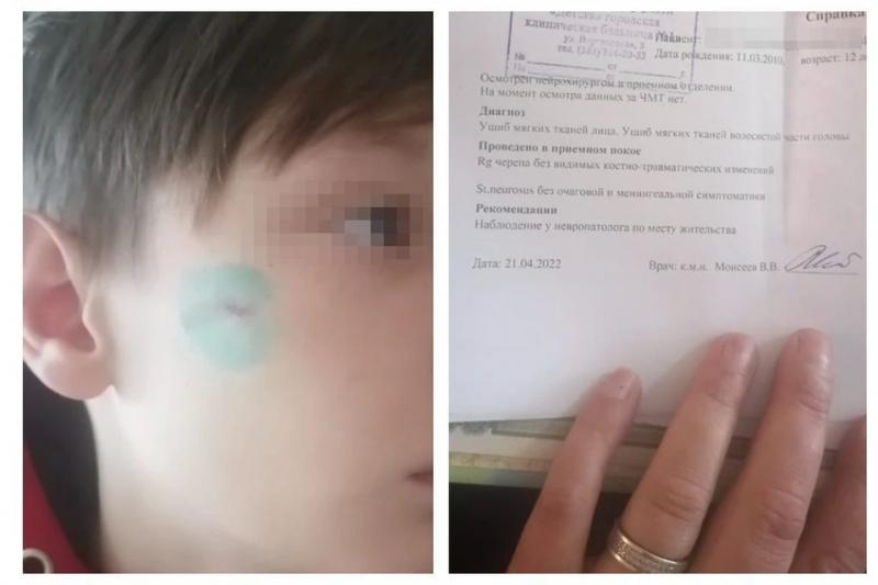Мужчина в камуфляже избил 12-летнего мальчика