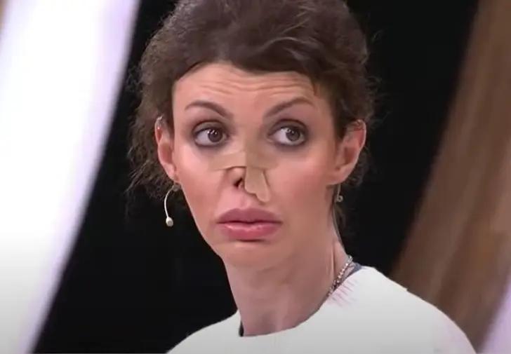 Наконец может любоваться собой: Алиса Аршавина, перенесшая множество операций на нос, вернула уверенность