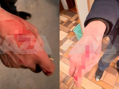 Отобрали жильё и чуть не убили: Пенсионер из Подмосковья остался без крыши над головой после &laquo;сделки мечты&raquo;